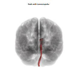 Medial Lemniscus