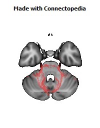 Middle_cerebellar_peduncle140