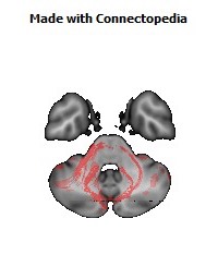 Middle_cerebellar_peduncle144