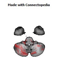 Middle_cerebellar_peduncle152