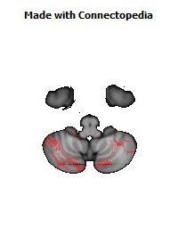 Middle_cerebellar_peduncle154