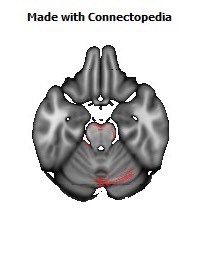 Middle_cerebellar_peduncle130