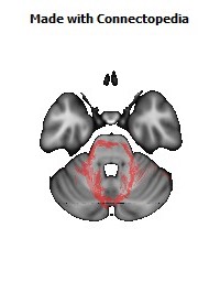 Middle_cerebellar_peduncle138