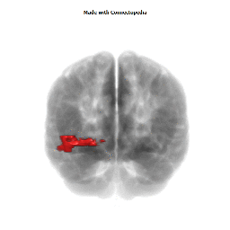 Inferior Occipital Gyrus