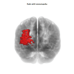 Middle Occipital Gyrus