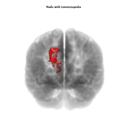 Superior Occipital Gyrus