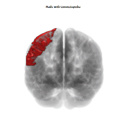 Post-Central Gyrus