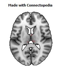 Posterior_Commissure096