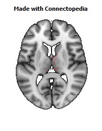 Posterior_Commissure098