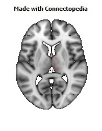 Posterior_Commissure100