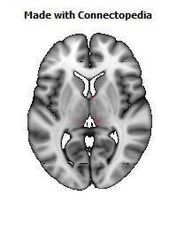 Posterior_Commissure102