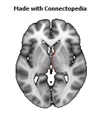 Posterior_Commissure106