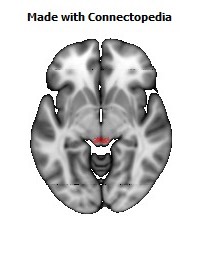 Posterior_Commissure114