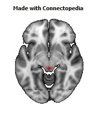 Posterior_Commissure116