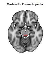 Posterior_Commissure122