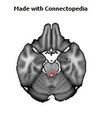 Posterior_Commissure130