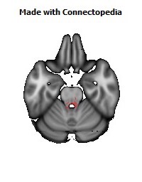 Posterior_Commissure132