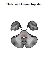 Posterior_Commissure148