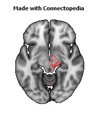 Posterior_corona_radiata_R118