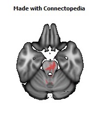 Posterior_corona_radiata_R132