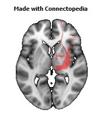 Posterior_corona_radiata_R106