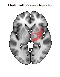 Posterior_corona_radiata_R108