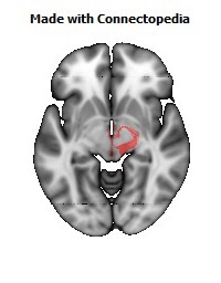 Posterior_corona_radiata_R114