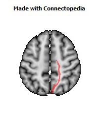 Posterior_limb_of_internal_capsule_R058