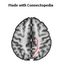 Posterior_limb_of_internal_capsule_R062