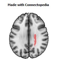 Posterior_limb_of_internal_capsule_R078