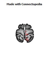 Posterior_limb_of_internal_capsule_R036