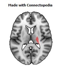 Posterior_limb_of_internal_capsule_R096