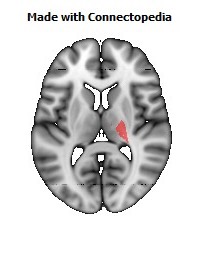 Posterior_limb_of_internal_capsule_R098