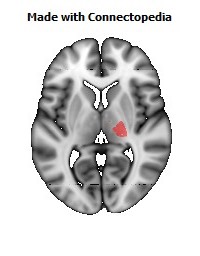 Posterior_limb_of_internal_capsule_R102