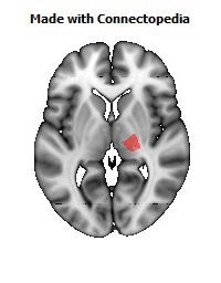 Posterior_limb_of_internal_capsule_R104