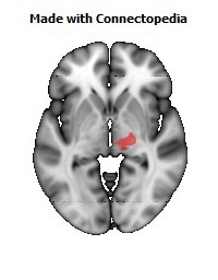 Posterior_limb_of_internal_capsule_R110