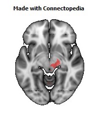 Posterior_limb_of_internal_capsule_R116