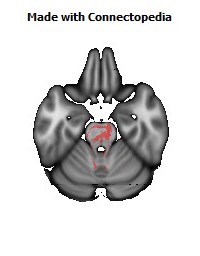 Posterior_limb_of_internal_capsule_R132