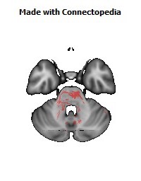 Posterior_limb_of_internal_capsule_R140