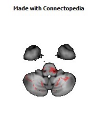 Posterior_limb_of_internal_capsule_R152