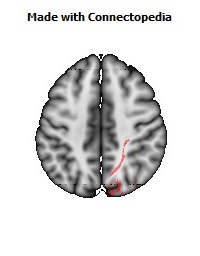 Posterior_thalamic_radiation_R064