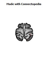 Posterior_thalamic_radiation_R036