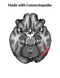 Posterior_thalamic_radiation_R126