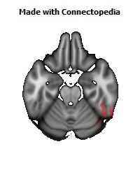 Posterior_thalamic_radiation_R130