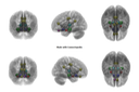 Morphological and Connectomic Atlas of Human Brain Functions