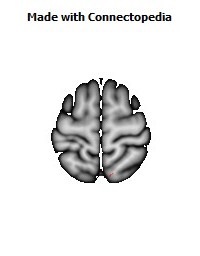 Sagittal_stratum_R044