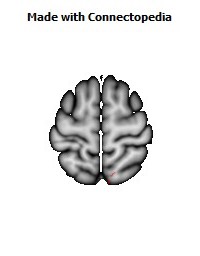 Sagittal_stratum_R046