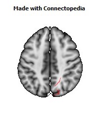 Sagittal_stratum_R064