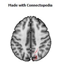 Sagittal_stratum_R066