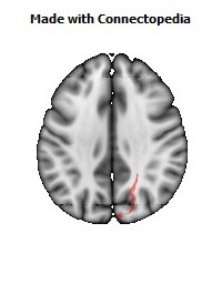 Sagittal_stratum_R072